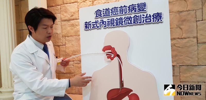 ▲台灣有四分之一人口飽受胃食道逆流之苦,普遍民眾會服用抑制胃酸的藥物,來抑制其所帶來的痛苦。(圖/記者陳雅芳攝,2020.06.15)