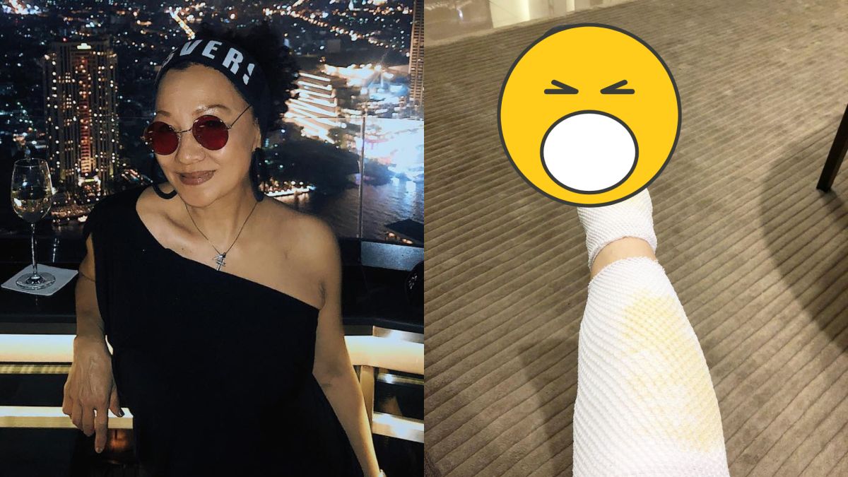 ▲比莉上傳腳傷照，腳上的知名精品品牌拖鞋成為亮點。（圖／比莉IG）