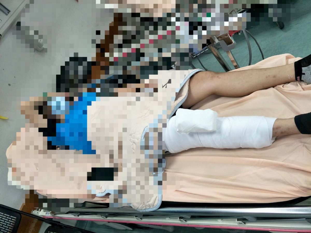 ▲受害女學生右腿脛骨骨折。（圖／記者陳聖璋翻攝）