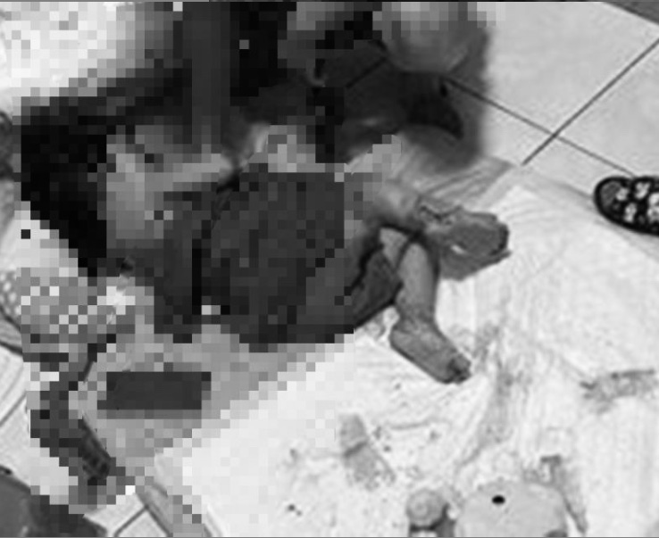 ▲台南一名女童2週前遭燙傷，家屬竟未帶女童就醫，導致傷口嚴重惡化。（圖／翻攝臉書社團）