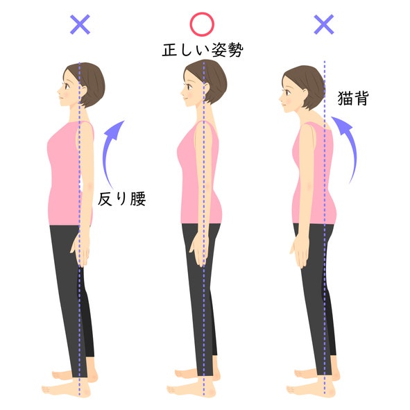 Comparison of good posture and bad posture © fuwari