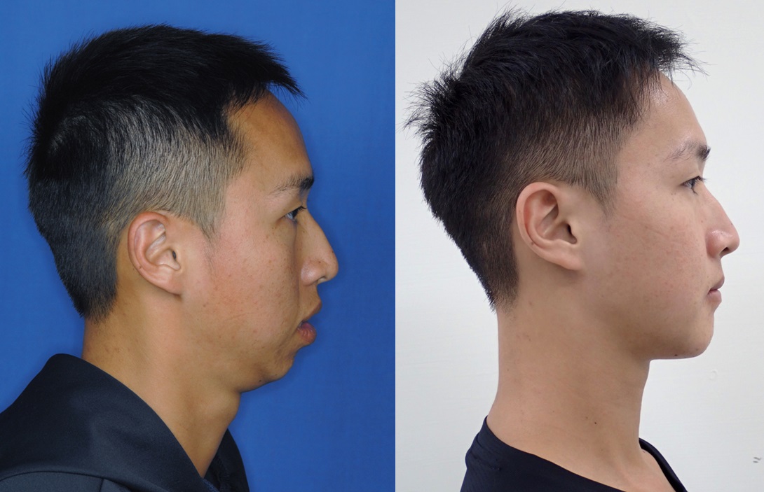 ▲術前術後對照圖。（圖／成大醫院提供）