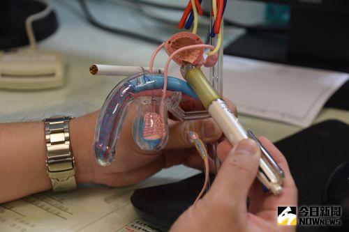 膀胱癌 ▲根據大型研究尿路上皮癌病患治療後,戒菸可以降低50%的復發率。(圖/記者陳雅芳攝,2020.07.08)