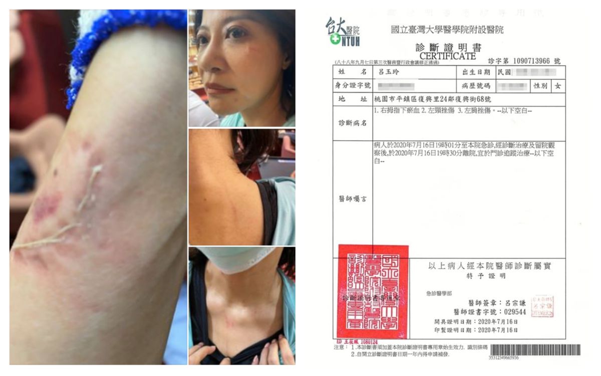 ▲民進黨立委林楚茵指控被國民黨立委呂玉玲咬傷，在臉書上po出齒痕清晰的照片。呂玉玲則反批是林楚茵先揮拳，還po出台大醫院的驗傷單（右）。（圖／翻攝林楚茵、呂玉玲臉書）