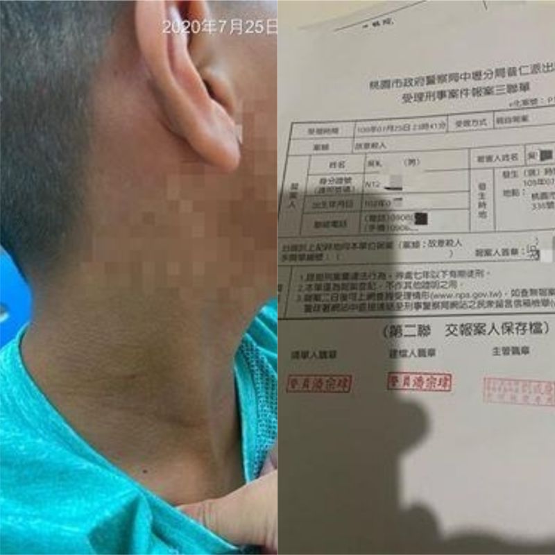 ▲原PO指出,對方在報警後還說要不要和解,可以給200塊醫藥費。(圖/翻攝自