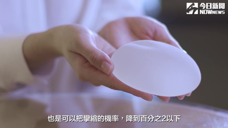 ▲藉由術後適度的按摩,以及選擇適當的植入層次,就能大幅降低其發生率至2%以下。(圖/NOWnews攝)