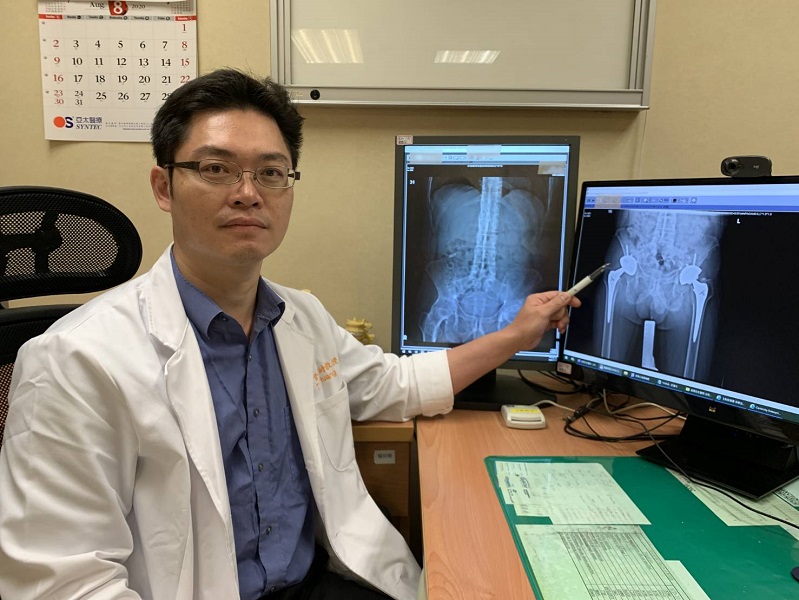 ▲嘉義長庚醫院關節重建科黃贊文主任對廚師進行了雙側全人工髖關節置換手術，讓他重新回到廚師生涯。(圖／嘉義長庚醫院提供）