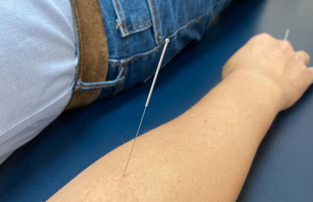 ▲一名新手爸爸因為長期抱兒子，出現手肘劇痛，進行乾針治療。（圖／亞大醫院提供）