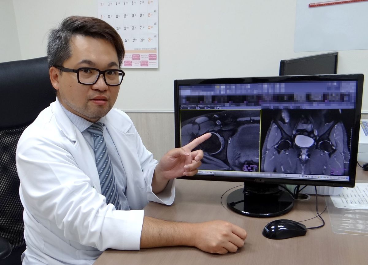 ▲奇美醫學中心骨科部主治醫師林敬為表示，髖關節疼痛有許多可能的原因，其中髖關節關節唇破裂所佔的比例並不少。（圖／奇美醫學中心提供）