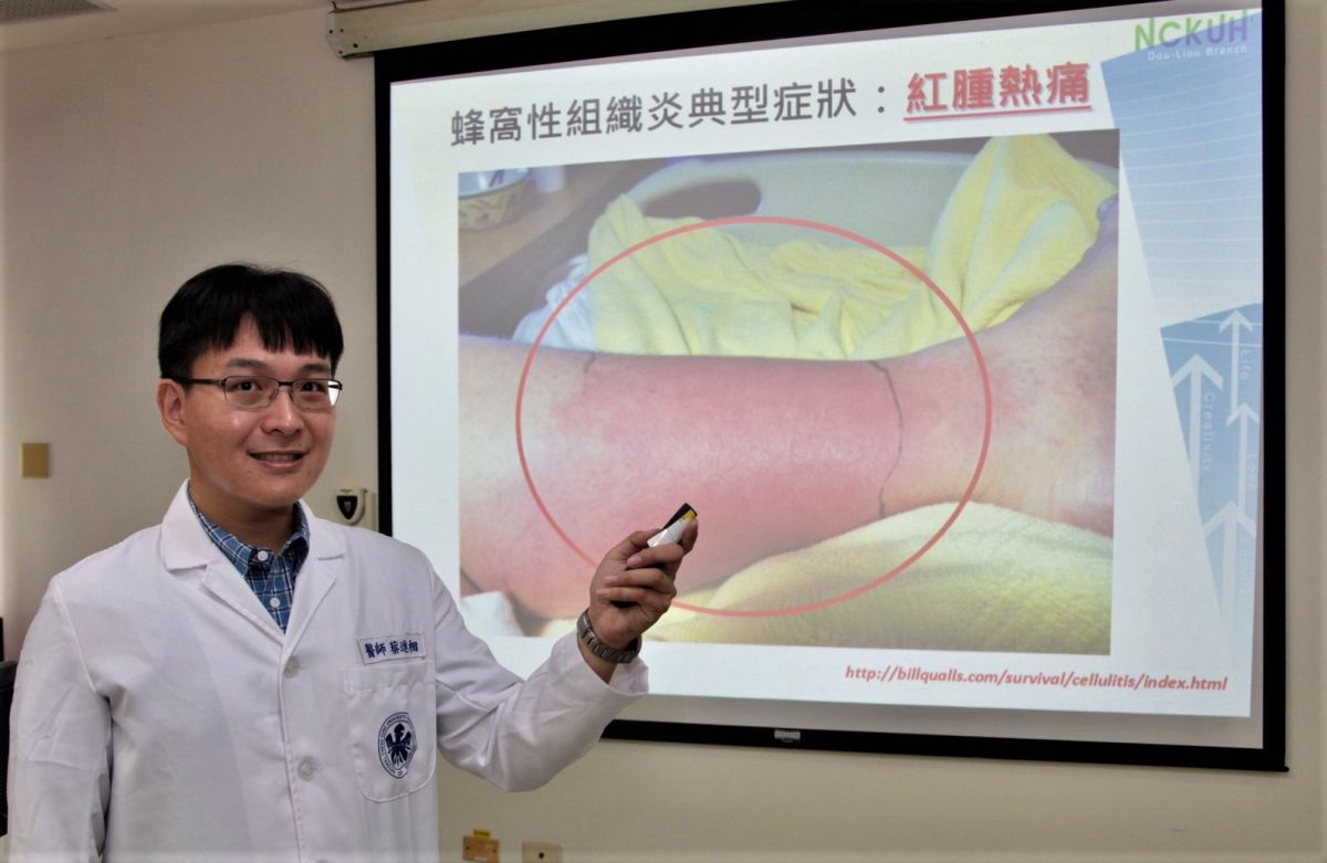 ▲感染病科蔡進相醫師表示皮膚紅腫熱痛不容忽視。（圖／記者蘇榮泉攝，2020.08.27）