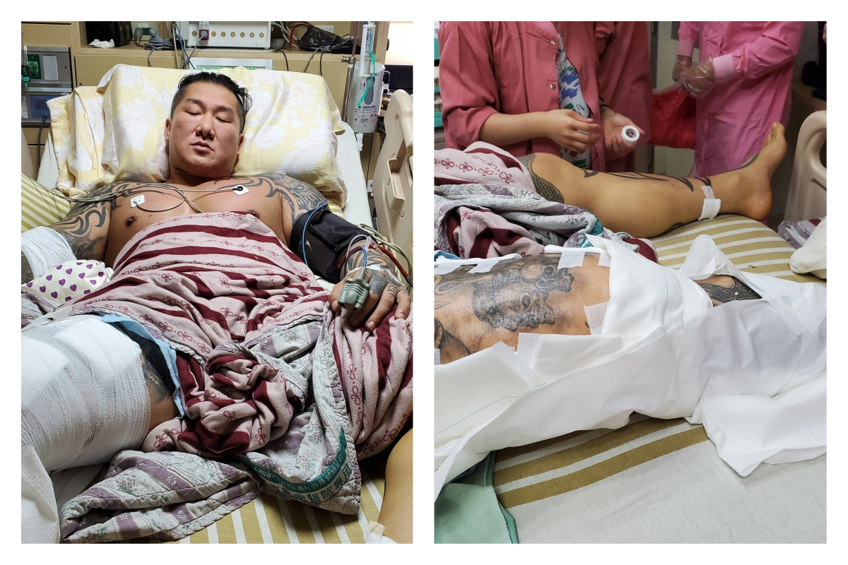 ▲館長遭槍擊後，住院照片首度曝光。（圖／翻攝自飆捍臉書）