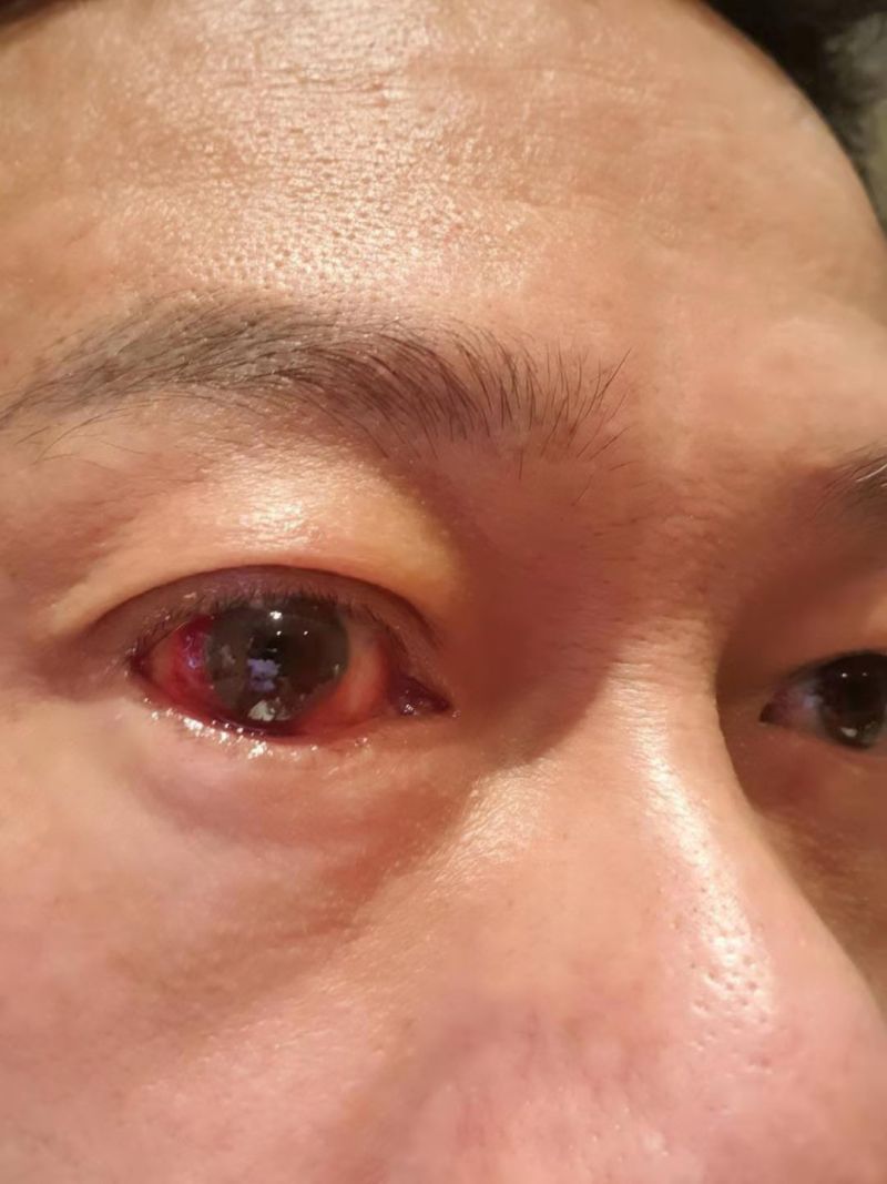 ▲李康生眼睛充血,如電影中邪樣貌。(圖/李康生提供)
