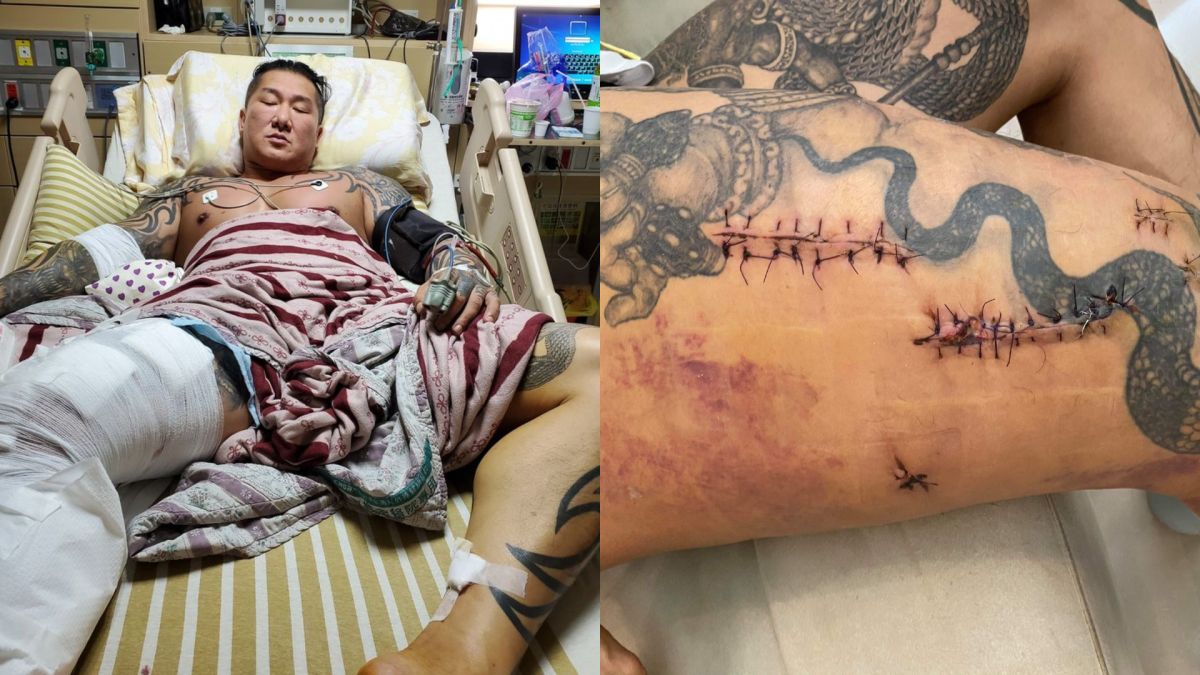 ▲館長深夜想到「大腿廢掉」，忍不住紅了眼眶。（圖／飆捍臉書）