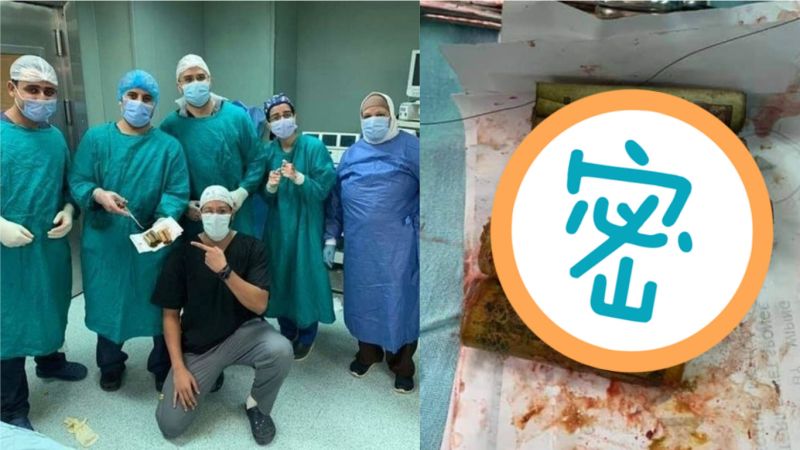 男胃痛急開刀!醫取出「4捲鈔票」全傻眼:把零錢當零食
