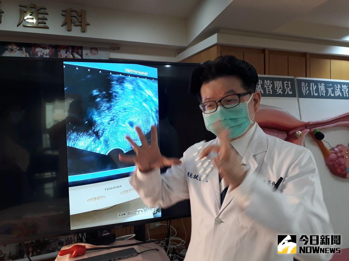 ▲婦產科醫師提醒女性朋友應做好避孕的自我保護措施，以免意外懷孕墮胎後可能造成的身心創傷等後遺症。（圖／記者陳雅芳攝，2020.09.15）