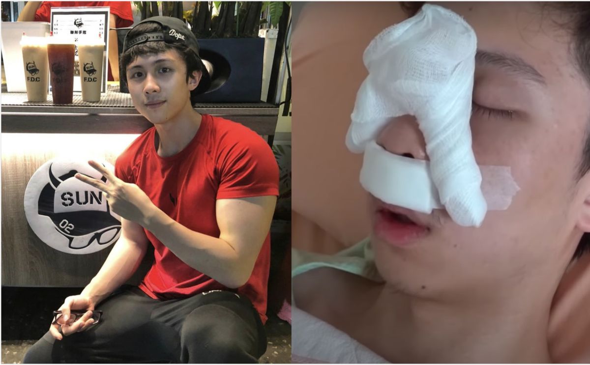 ▲孫安佐上傳一段影片，透露自己為了20年的隱疾動了一項手術，親揭消失一個月時間的原因，以及手術後復原過程。（合成圖／翻攝自孫安佐IG／YouTube《Sun孫安佐的頻道Edward》）