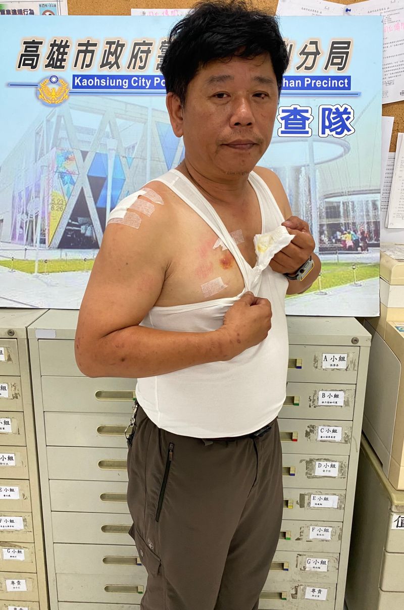 ▲鳳山分局偵查隊小隊長陳昭元為防止犯嫌逃跑遭犯嫌咬右胸,右胸口傷痕清晰可見,手腳也有多處擦挫傷。(圖/記者郭凱杰翻攝)