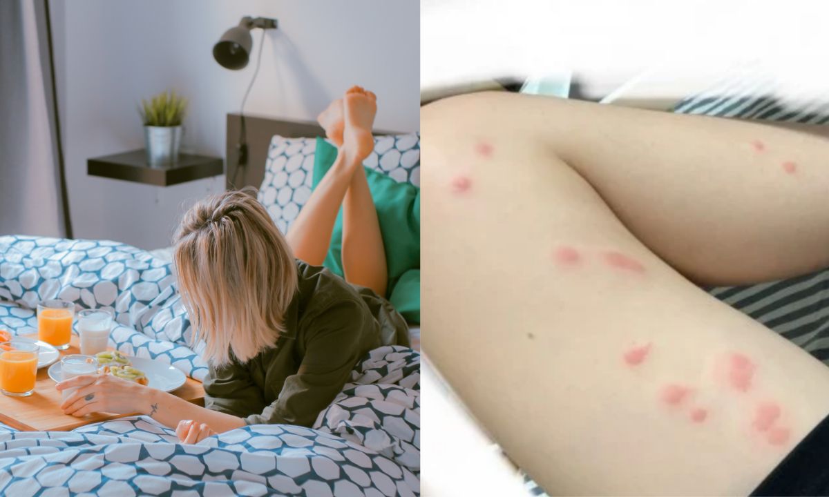 ▲有名女網友和家人近日到北投一間溫泉旅館，豈料一入住竟然「全身紅腫發癢」，貼文一出，引起熱議。（左示意圖，圖中人物與文章中內容無關，取自unsplash／右圖，翻攝自《Dcard》）