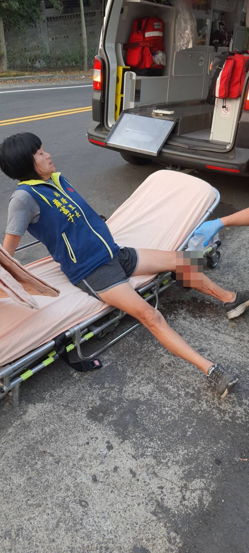 ▲員林市林厝里里長蕭富子今早散步運動,結果遭到一隻大型流浪狗攻擊,蕭富子腿部被咬到流血。(圖/蕭富子提供,2020.10.29)
