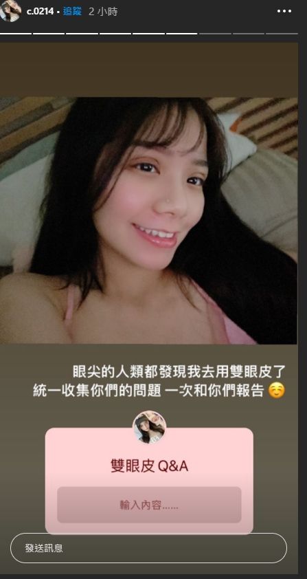 ▲青青眼睛明顯浮腫。(圖/青青IG)