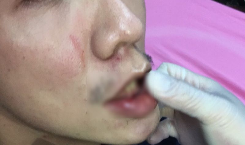 ▲遭郭男毆打的員警,臉部、頸部及手部多處擦挫傷,因郭襲警,警詢後被依妨害公務、傷害罪嫌移送橋頭地檢署偵辦。(圖/記者郭凱杰翻攝)