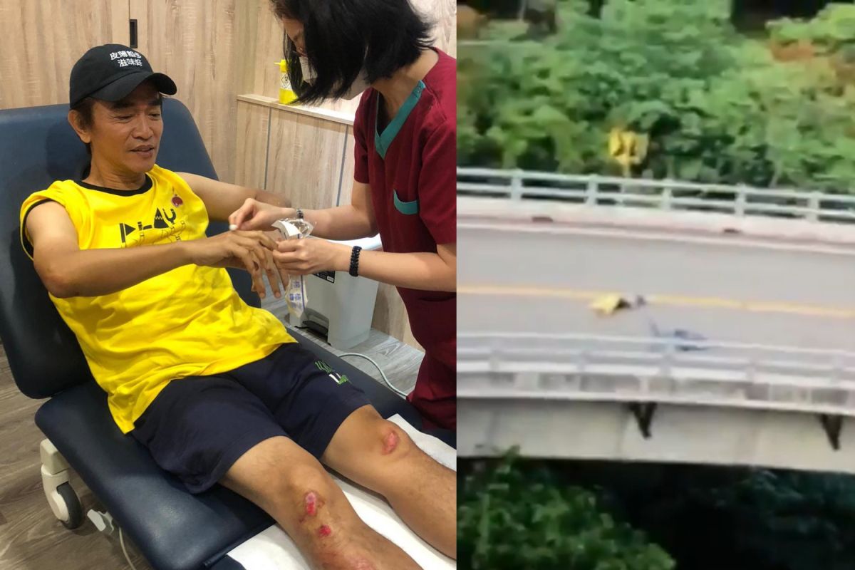 ▲吳宗憲連人帶車慘摔，自曝7秒驚險畫面。（圖／吳宗憲IG） 