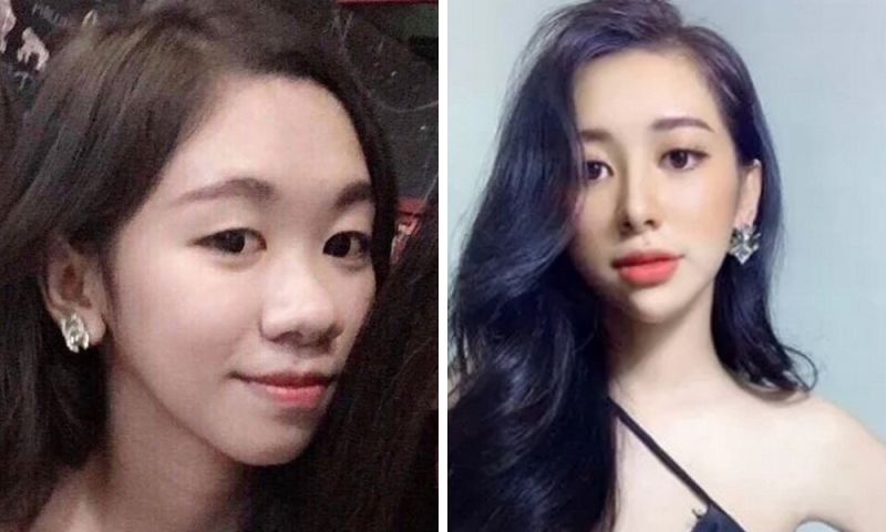 ▲Nguyen Tuong Vy 大方在社群媒體上講述她 19 歲動刀的故事，表示整型後她終於變得有自信。（圖／翻攝自臉書）