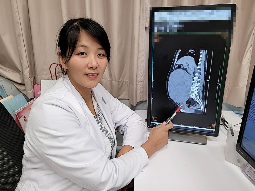 ▲醫生指著肌瘤如懷孕。(圖／林重鎣攝2020.11.25)