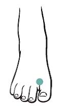 ▲燃脂瘦身的穴位。（圖／采實文化 ）