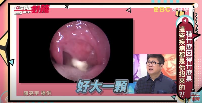 ▲耳鼻喉科醫師陳亮宇在節目《醫師好辣》分享曾遇過的個案。（圖／翻攝自《醫師好辣》YouTube）