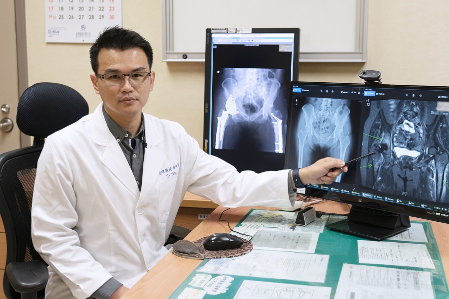 ▲嘉義長庚醫院楊典育醫師表示，因環境及飲食習慣改變，國人罹癌發生年紀有逐漸年輕的趨勢。(圖／長庚醫院提供）