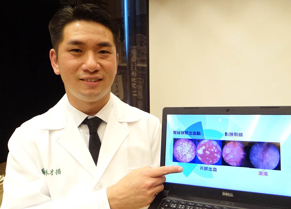 ▲奇美醫學中心泌尿外科主治醫師林才揚說明，有間質性膀胱炎的病人膀胱會出現腎絲球狀出血點、出血斑、片狀出血或黏膜裂縫的現象。（圖／記者林怡孜攝，2020,12,15）