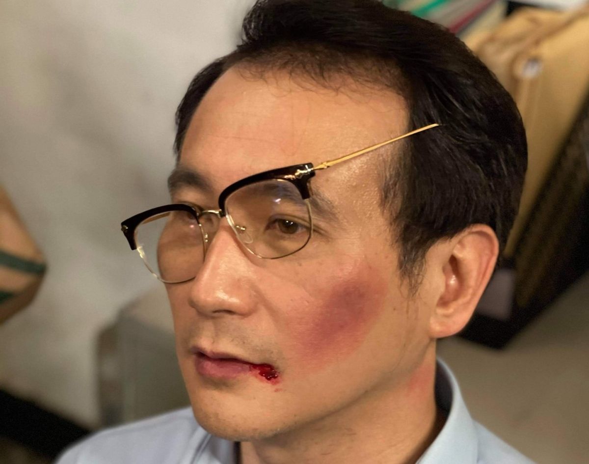 ▲立委鄭運鵬出演國際橋牌社被打的角色，他表示大學時曾被星探相中，但後來沒有出道，現在能出演戲劇是很有趣的體驗，未來也願意無償參與。　（圖／翻攝鄭運鵬臉書）