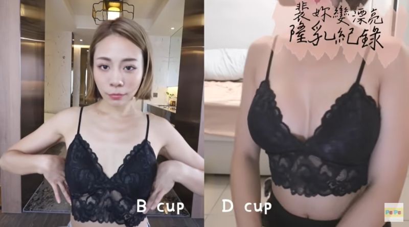 ▲裴薇公開術前(左)和術後(右)的對比。(圖/裴薇Youtube)