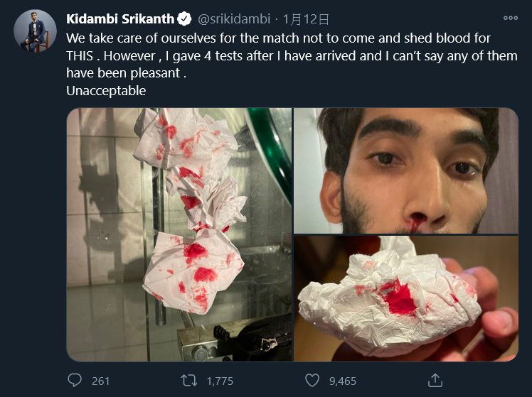 ▲新冠肺炎檢測方式讓人相當不適,前印度球王Srikanth