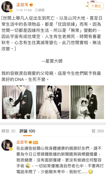 ▲孟庭葦回應臉部僵硬。(圖/孟庭葦微博)