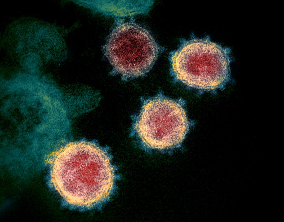 全世界為COVID-19封城最久的澳洲墨爾本，根據官員表示，將於本週內解除居家防疫令。鄰國紐西蘭加強疫苗接種，學習與COVID-19和平共處。新冠病毒在穿透式電子顯微鏡下現形，可見病毒表現突起的棘冠。因新冠病毒是 RNA 病毒，突變速度快。中研院團隊將目前新冠病毒變異分為六大類型，目前全球流傳的幾乎都是第六類型病毒，未來團隊將持續追蹤病毒變異。（圖／研之有物）