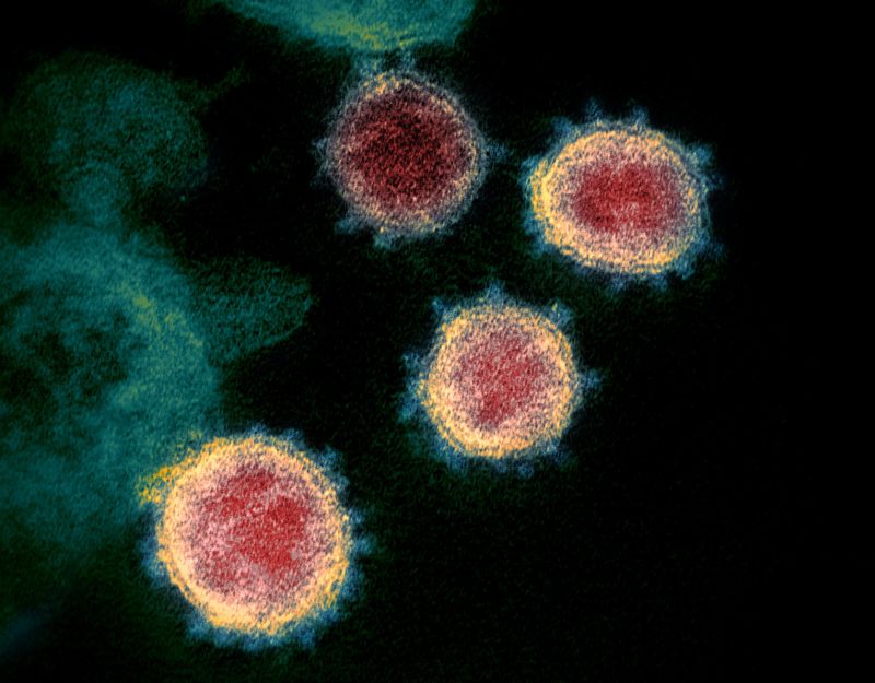 ▲新冠病毒在穿透式電子顯微鏡下現形，可見病毒表現突起的棘冠。因新冠病毒是