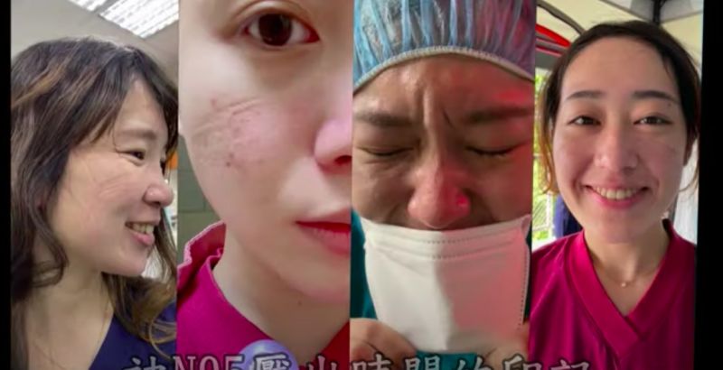 ▲部桃醫院的醫護人員因長期配戴N95口罩，臉上都有烙印。（圖／Cheng Chris YT）