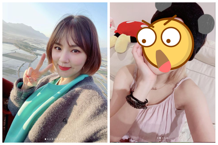 ▲熊熊日前跌倒掛急診，在IG貼出自拍照，傷勢曝光。（圖／翻攝熊熊IG）