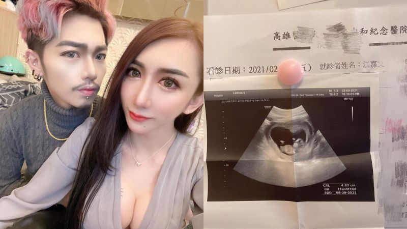 網紅罔腰「沒卵沒子宮」竟懷孕 婦科醫師打臉:不要鬼扯