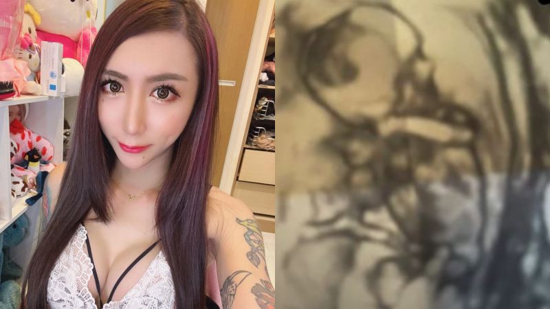 ▲罔腰曝光第二張超音波照。(圖/罔腰IG)