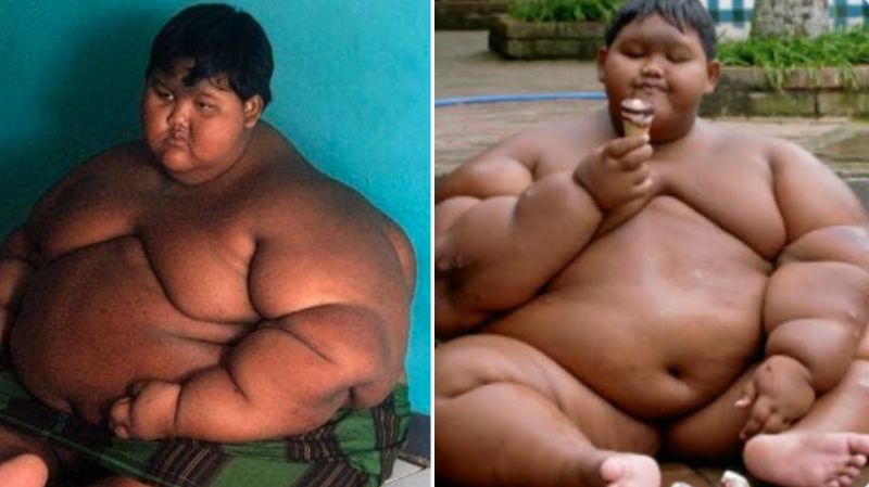 ▲有「世界最胖男孩」之稱的印尼男孩帕馬納（Arya