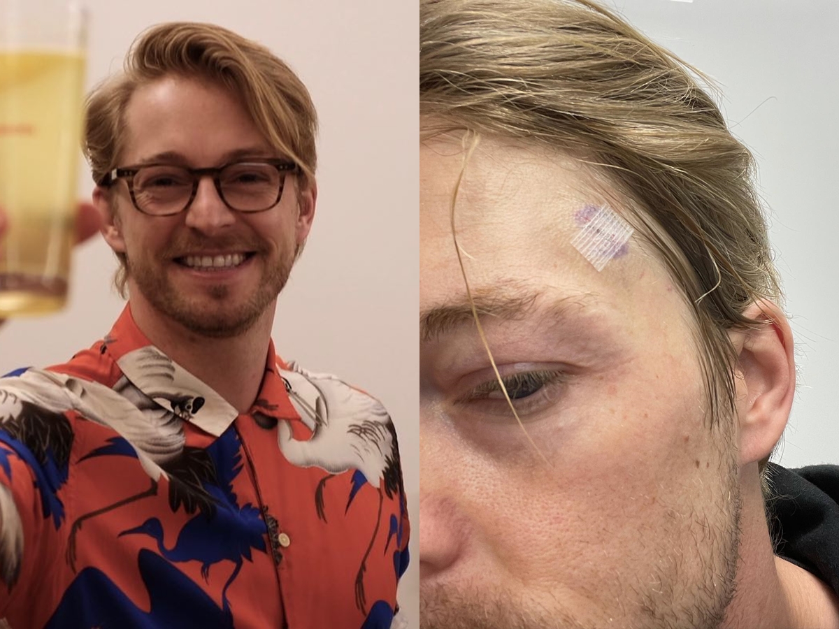 ▲法比歐長腫瘤。（圖／翻攝法比歐臉書）