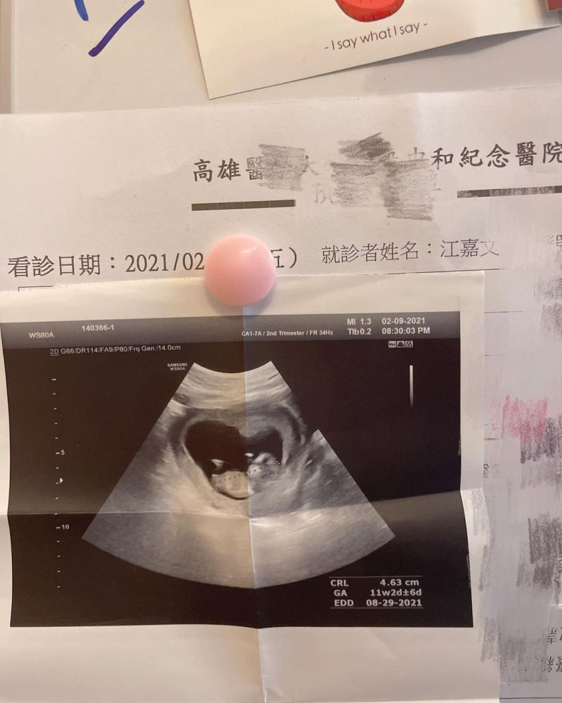 ▲罔腰公布超音波照，宣布懷孕胎12週。（圖／翻攝自罔腰IG@wen810615）