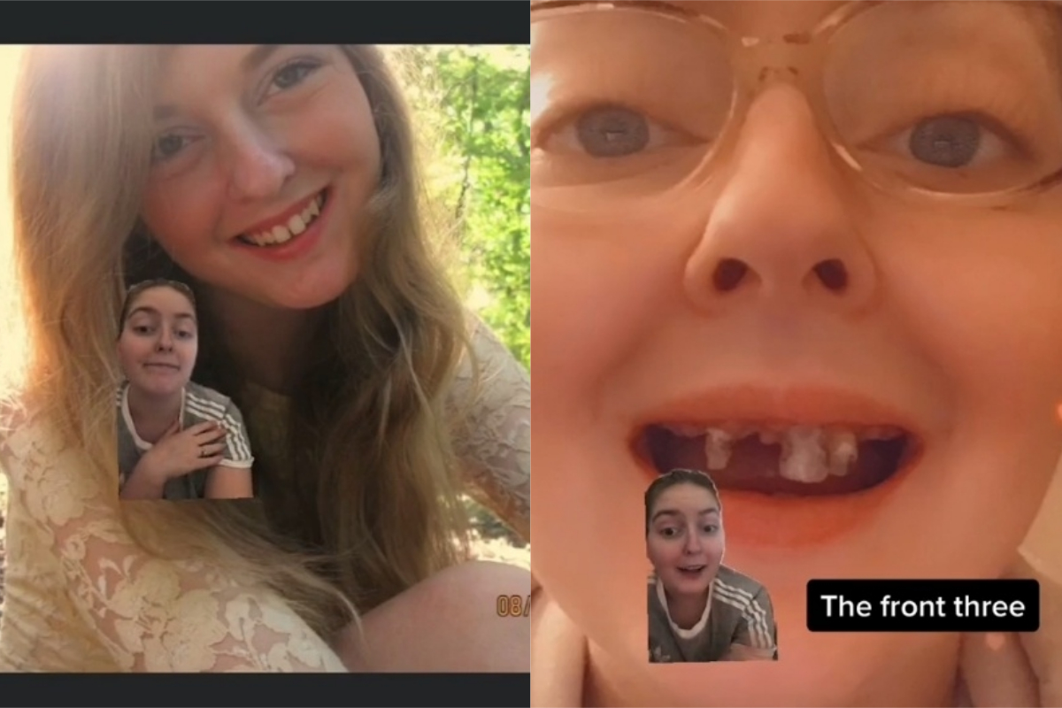 ▲美國一名女子10年來天天喝汽水又不愛刷牙，下場超級慘烈。（圖／翻攝自《@lilnovi95》抖音 ） 