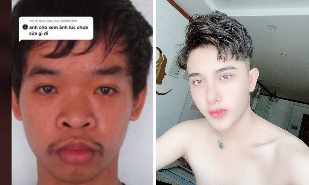 ▲一名越南抖音網紅近日大方分享自己的舊照，並自曝整形的心路歷程，引發網友討論。（圖／翻攝自抖音）