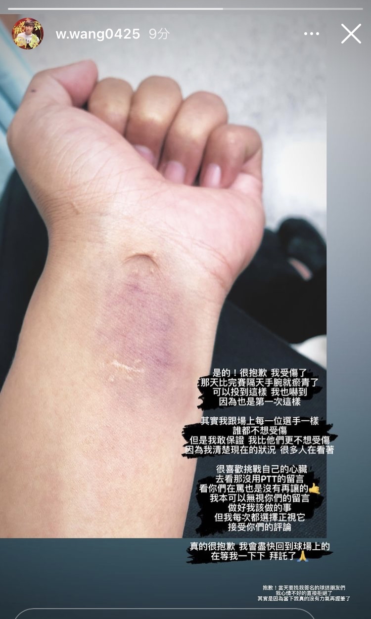 ▲王維中放上照片證明自己傷勢不假。（圖／取自王維中IG)