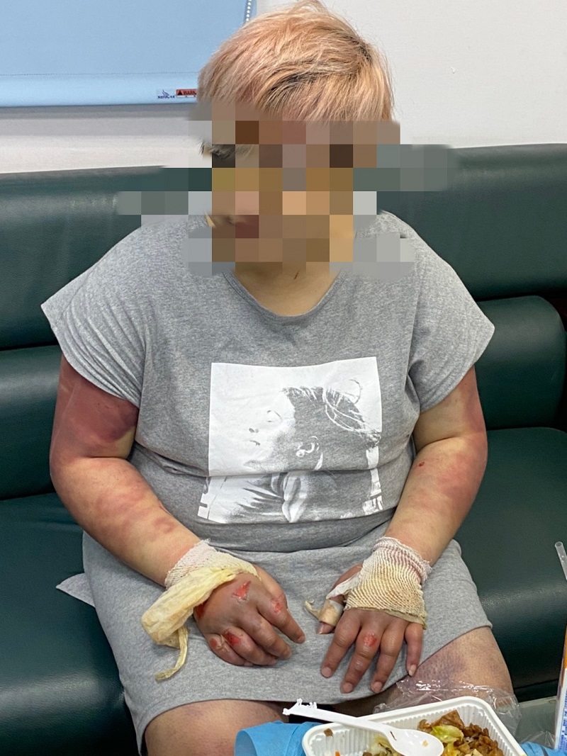 ▲葉姓美髮師被好友拘禁毆打得遍體鱗傷(圖/記者鄧力軍翻攝)