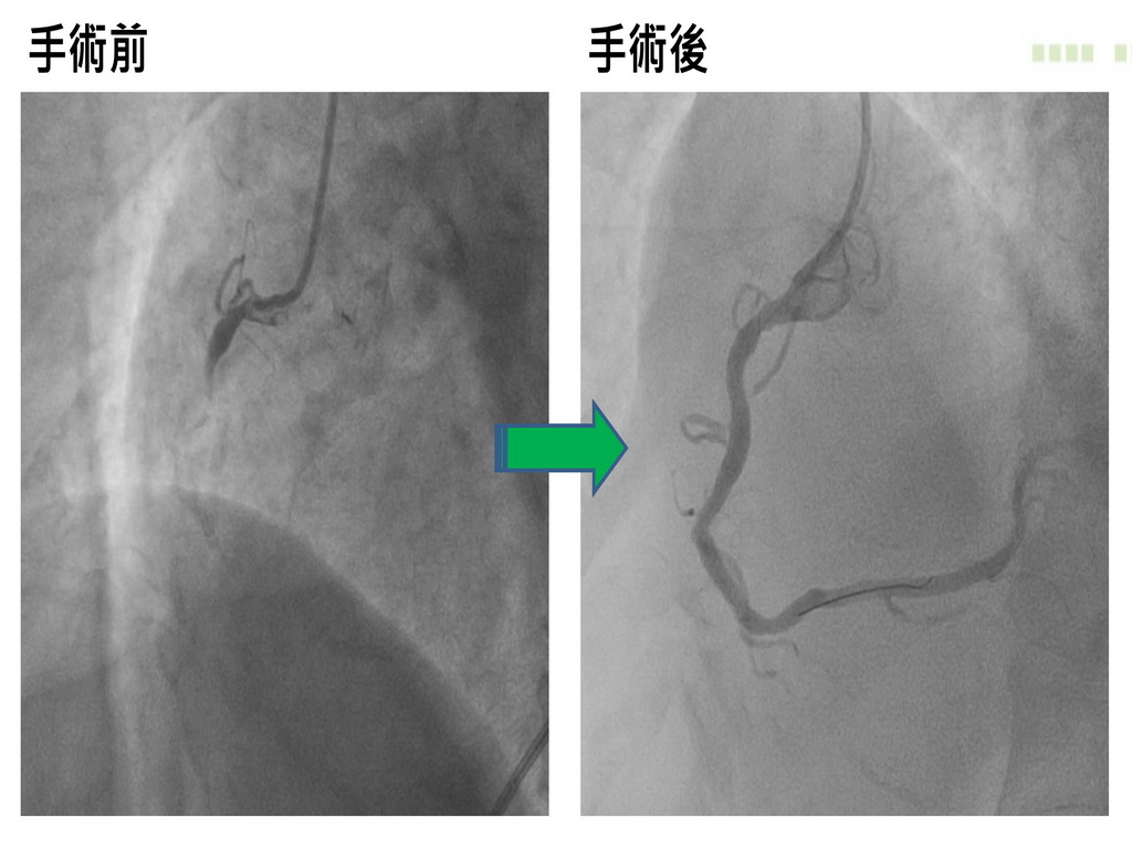 ▲心導管影像圖。(圖／醫院提供2021.3.28)